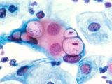 bakterie Chlamydia infekujące komórkę