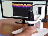 urządzenie do „wirtualnej biopsji” skóry metodą VOCT