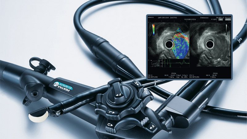 ultrasonograf endoskopowy firmy Pentax