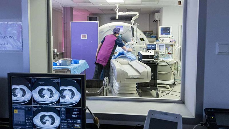 pierwszy w Polsce zabieg krioablacji nowotworu płuca przeprowadzony przez lekarzy z Warszawskiego Uniwersytetu Medycznego