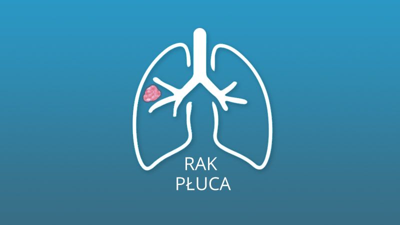 rak płuca - grafika poglądowa